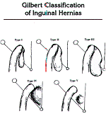 herniapic2.gif (7974 bytes)